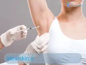 بوتاکس زیر بغل
