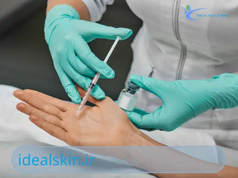 تزریق بوتاکس کف دست