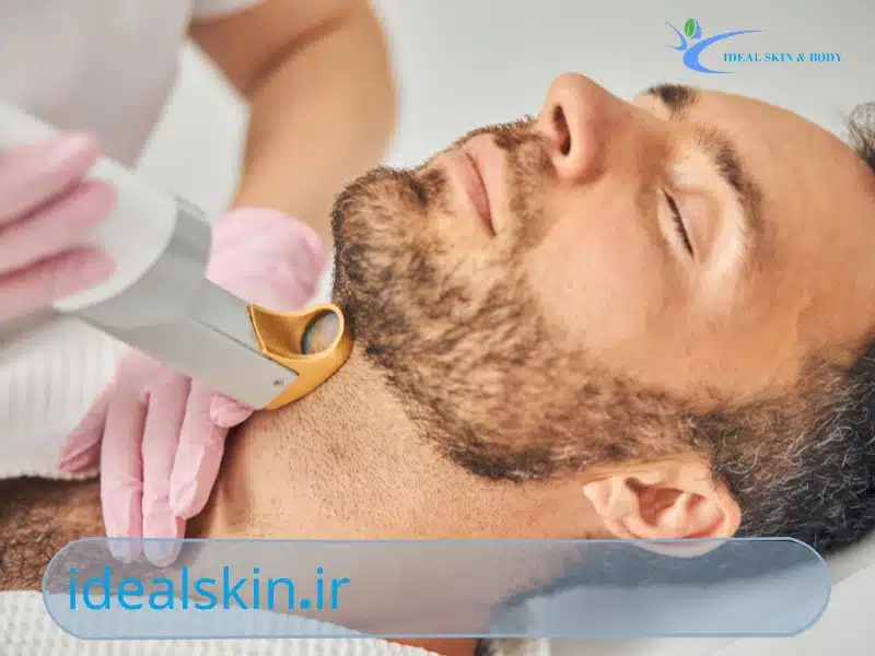 مراقبت های قبل از لیزر موهای زائد