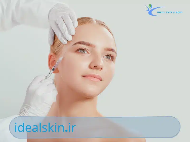 فیلر شقیقه