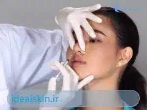 بوتاکس بینی