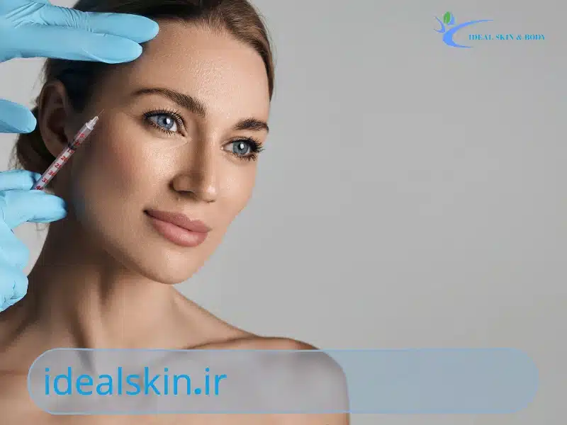 پی آر جی اف چیست