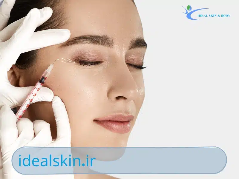 پی آر جی اف چیست