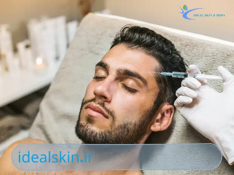 پی آر جی اف چیست