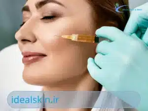 پی آرجی اف صورت
