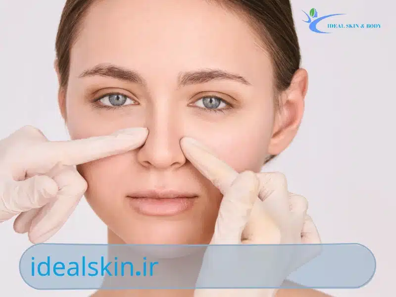 اثرات فیلر بینی و زمان مناسب برای عمل