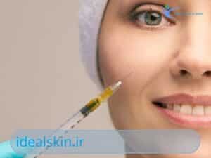 اهمیت مراقبت های پس از تزریق فیلر گونه