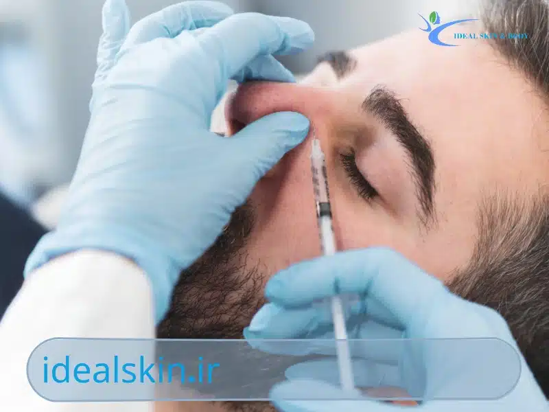 فیلر بینی برای بینی گوشتی