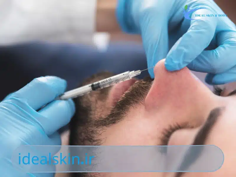فیلر بینی برای بینی گوشتی