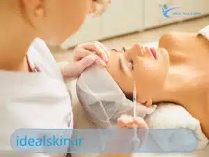 فیلر زیر چشم