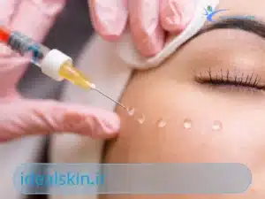 مزایای فیلر زیر چشم