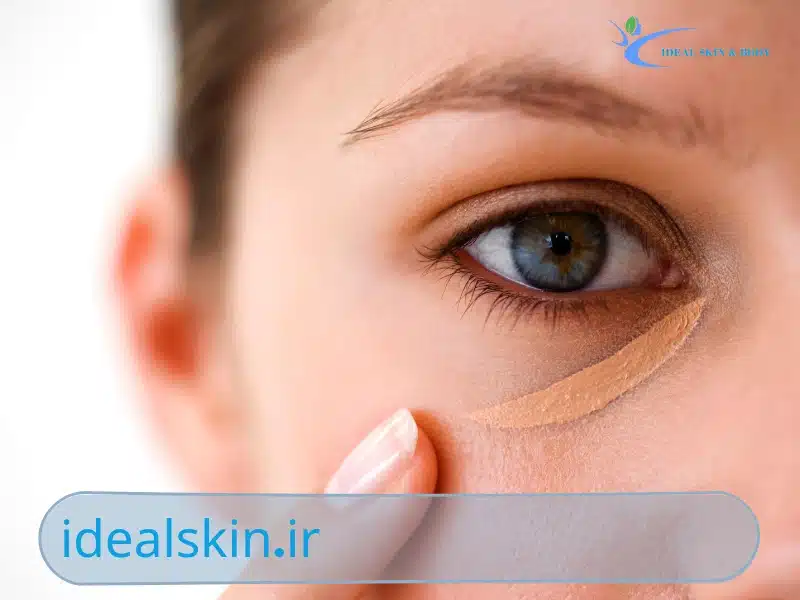 مزایای فیلر زیر چشم