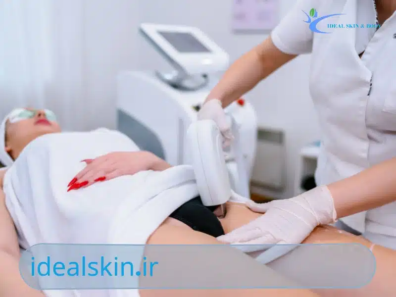 آیا لیزر باعث نازایی می‌شود