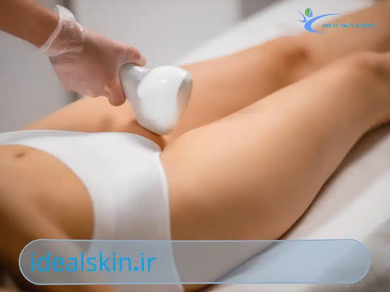 آیا لیزر باعث نازایی می‌شود