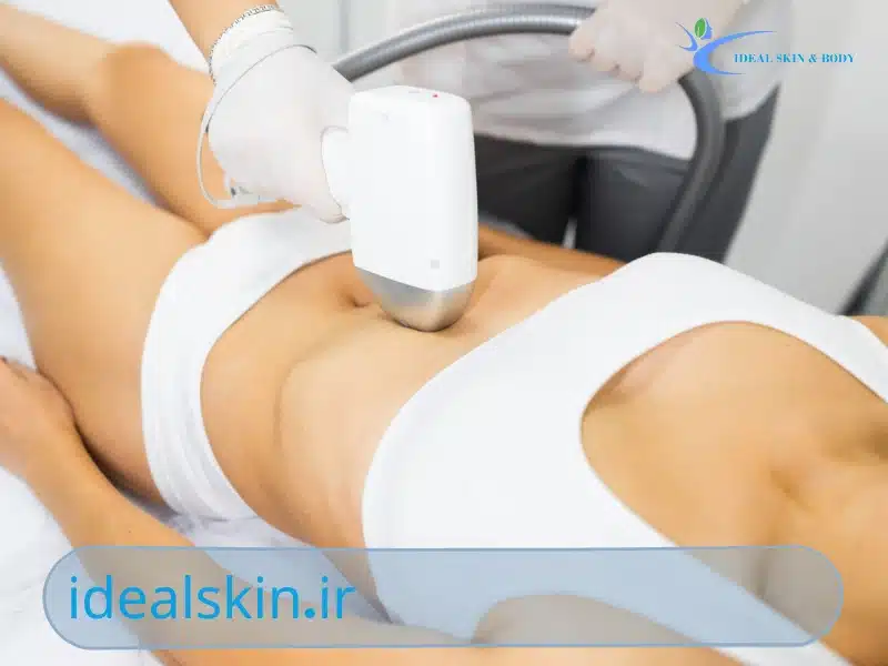 آیا لیزر باعث نازایی می‌شود