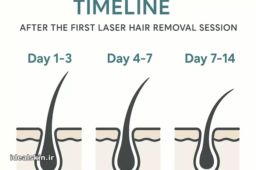  اینفوگرافیک زمان ریزش مو در سه مرحله