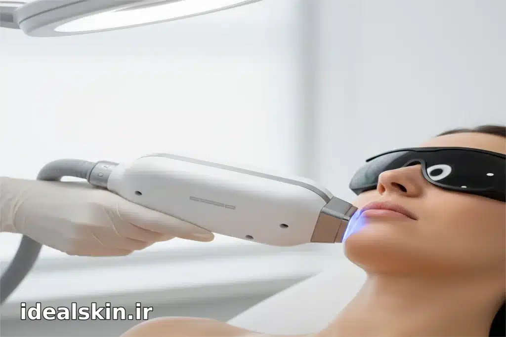 درمان لیزر زیر نور سفید