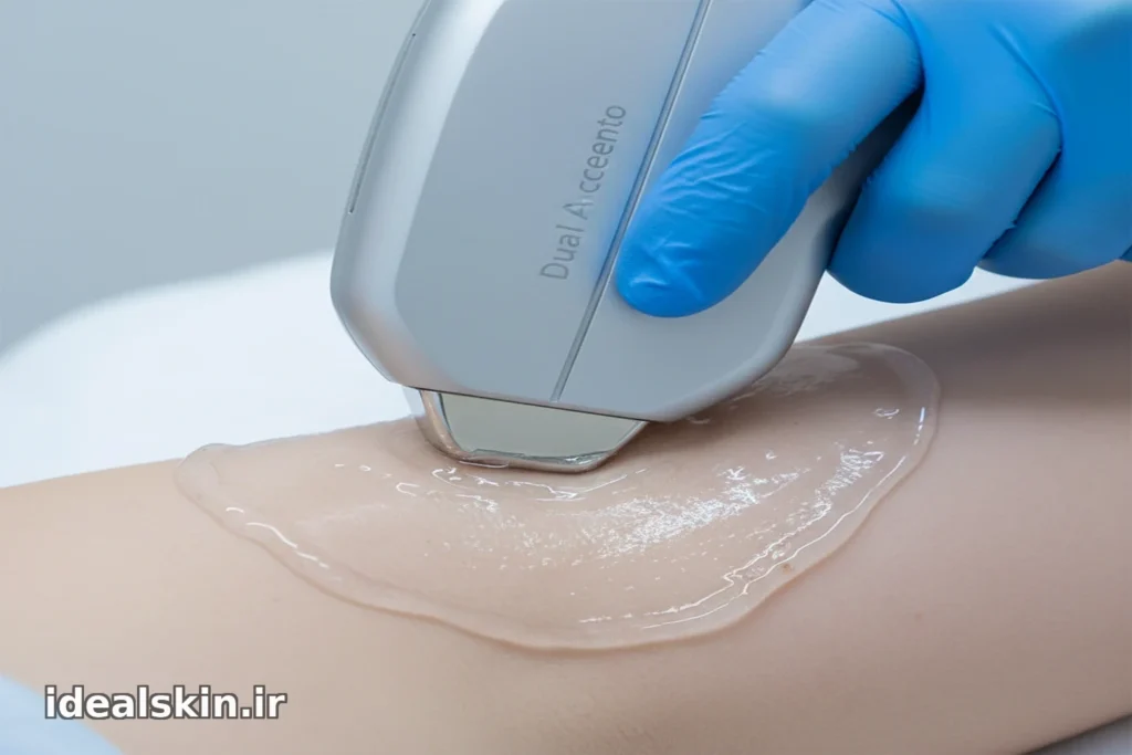  نمای ماکرو از هند‌پیس Dual Accento در زیر بغل با لایه ژل