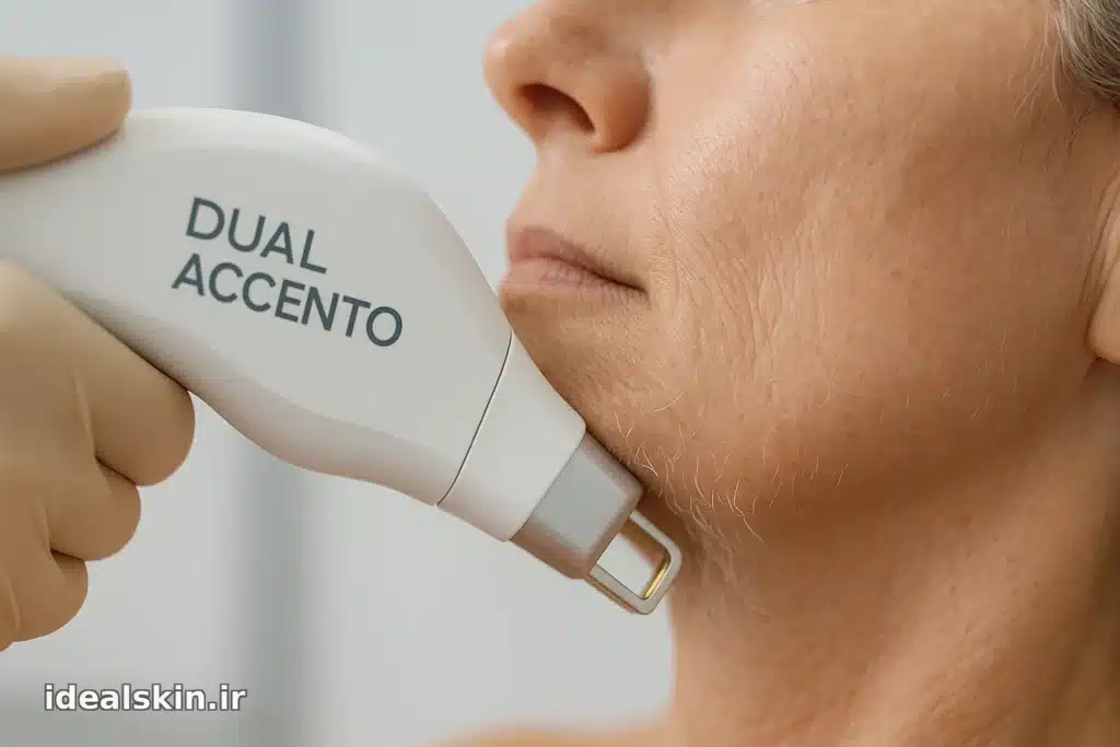 نمایش کنسول دستگاه Dual Accento پیش از درمان موهای سفید صورت