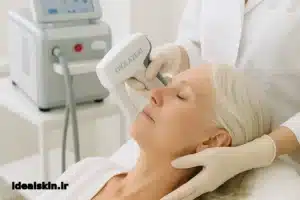 چرا لیزر موهای سفید بهراحتی از بین نمیرود؟