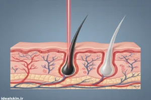 مقایسه فولیکول موی سیاه و موی سفید در مقطع پوست