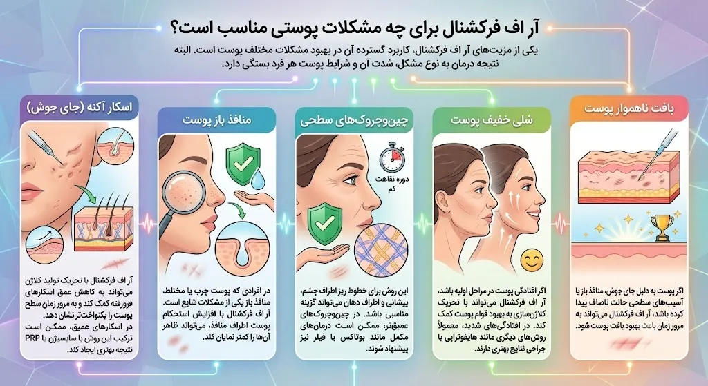 آر اف فرکشنال برای چه مشکلاتی مناسب است؟