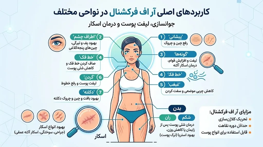 آر اف فرکشنال برای چه نواحی قابل استفاده است؟