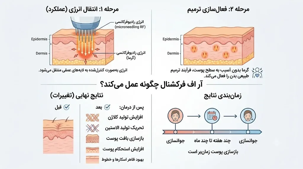 آر اف فرکشنال چگونه عمل میکند؟