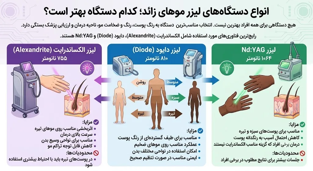 انواع دستگاههای لیزر موهای زائد