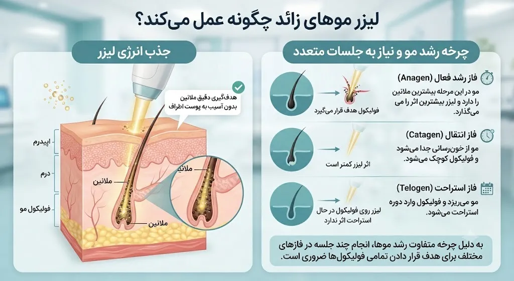 لیزر موهای زائد چگونه عمل میکند؟