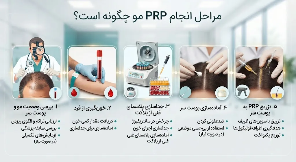 مراحل انجام PRP مو چگونه است؟