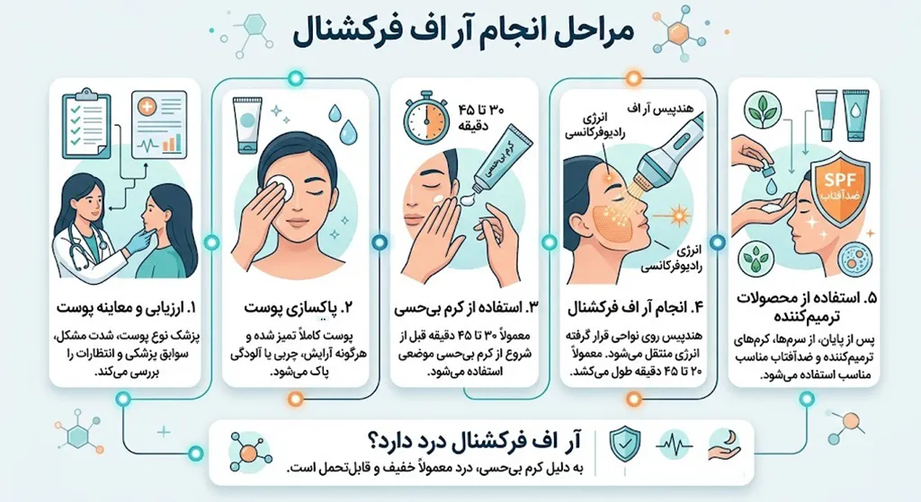 مراحل انجام آر اف فرکشنال