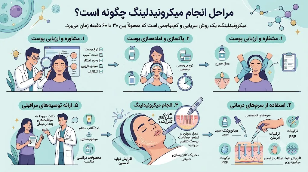 مراحل انجام میکرونیدلینگ چگونه است؟
