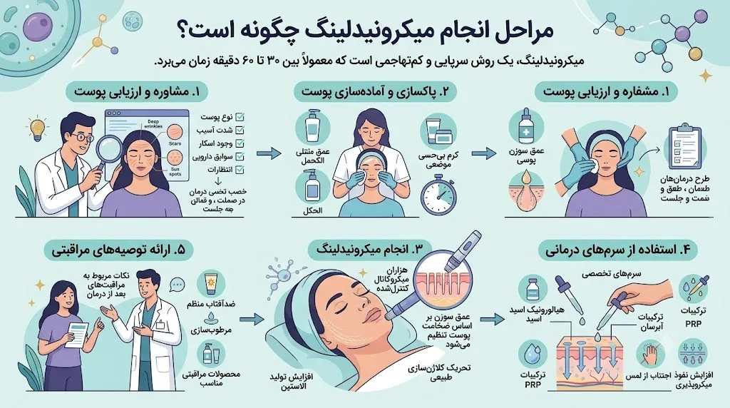 مراحل انجام میکرونیدلینگ چگونه است؟