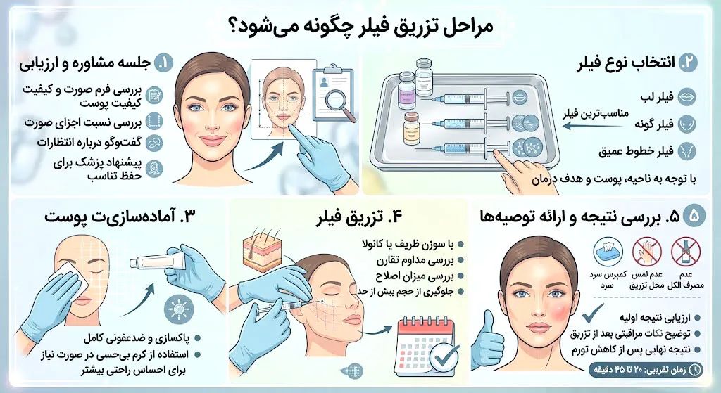 مراحل تزریق فیلر چگونه انجام می‌شود؟