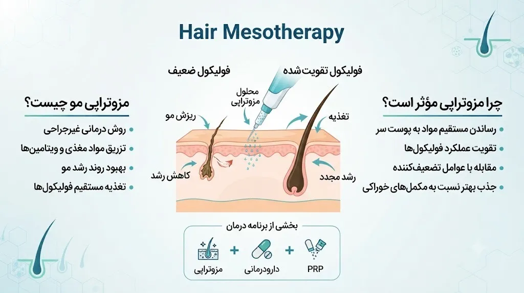 مزوتراپی مو چیست؟