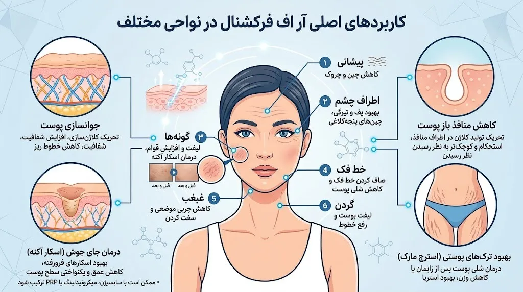 کاربردهای آر اف فرکشنال