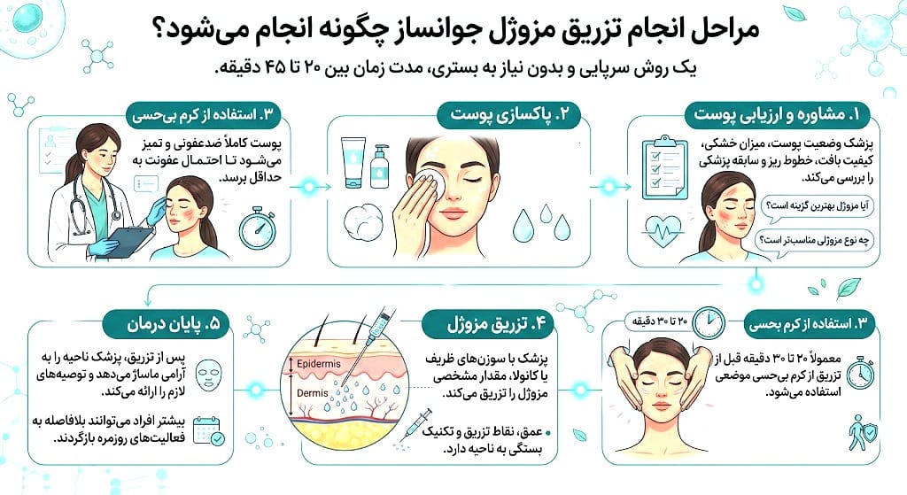 تزریق مزوژل جوانساز چگونه انجام میشود؟