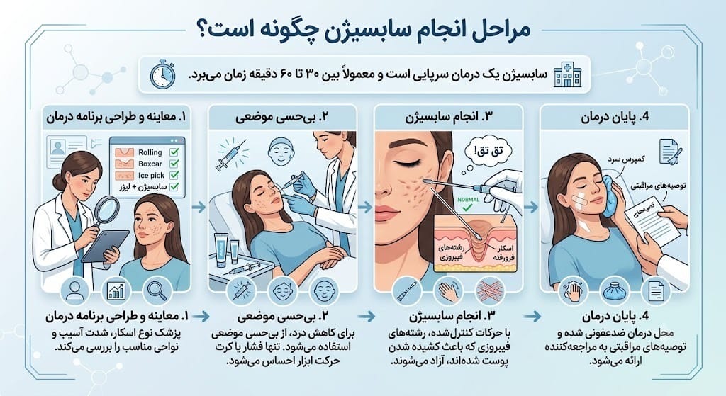 مراحل انجام سابسیژن چگونه است؟