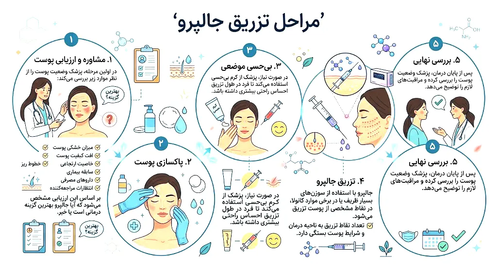 مراحل تزریق جالپرو