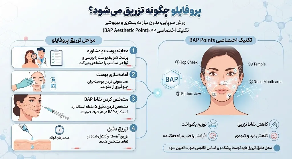 پروفایلو چگونه تزریق میشود؟