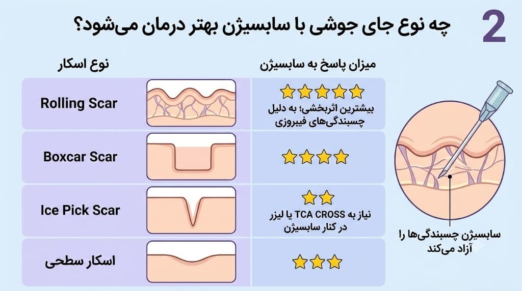 چه نوع جای جوشی با سابسیژن بهتر درمان میشود؟